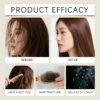 S2ad2e800a46a4435bb780df6f9e063a8H-2.webp Herbal Dandruff Removal Shampoo Bar Mild Tea Tree Oil Essence Oil Control Scalp Cleansing Hair Care Soap Hair Damaged Repairing