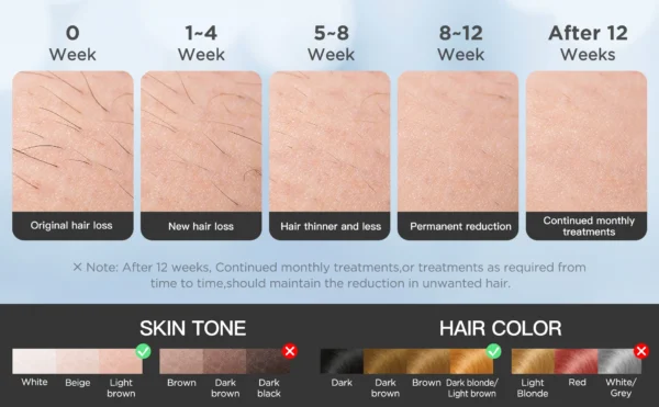 S32dbd61ccab24dc5a12fc53be1884d73a.webp INNZA Hair Removal with Ice Cooling Care Function for Women Permanent,999,999 Flashes Painless IPL Hair Remover Device