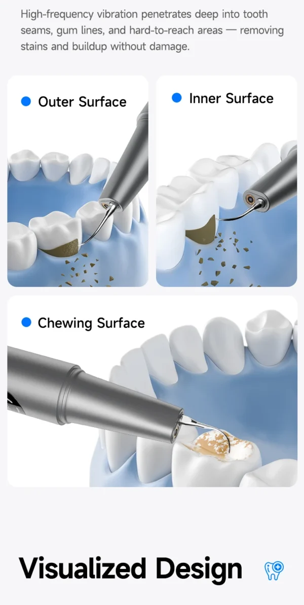 S4dc5bc2dad8d4ca2be24ac9bea0b5de3h.webp Visible Ultrasonic Dental Scaler Tartar Remover 5 modes with LED Light Household Teeth Cleaning Tools Dental Cleaner Oral Care