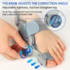 Sad147f68f29849618d309e1dd55c718ei.webp Unisex Bunion Corrector Foot Hallux Valgus Braces Rotatable Toe Separator Straightener Adjustable Pedicure Finger Toe Corrector